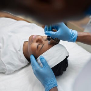 Chemical Peel
