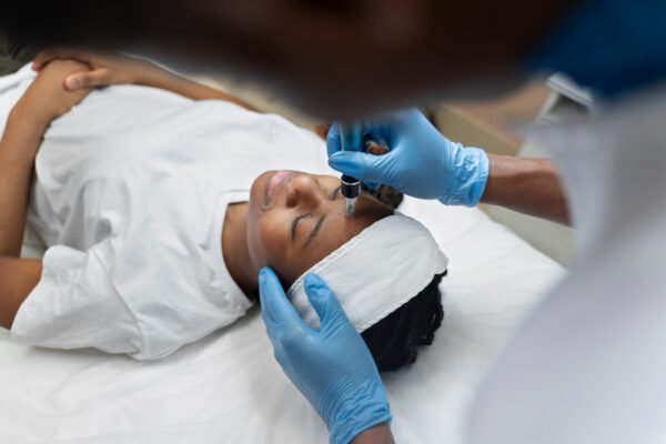 Chemical Peel